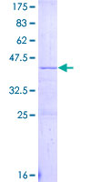 ab157900 on a 12.5% SDS-PAGE stained with Coomassie Blue.
