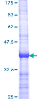 ab160084 on a 12.5% SDS-PAGE stained with Coomassie Blue.