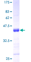 ab160170 on a 12.5% SDS-PAGE stained with Coomassie Blue.