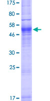 ab157901 on a 12.5% SDS-PAGE stained with Coomassie Blue.