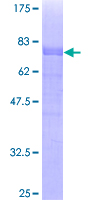 ab163196 on a 12.5% SDS-PAGE stained with Coomassie Blue.