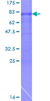 ab163197 on a 12.5% SDS-PAGE stained with Coomassie Blue.