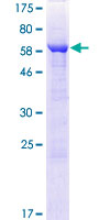 ab162118 on a 12.5% SDS-PAGE stained with Coomassie Blue.