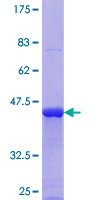 ab162119 on a 12.5% SDS-PAGE stained with Coomassie Blue.
