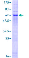 ab166565 on a 12.5% SDS-PAGE stained with Coomassie Blue.