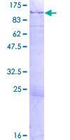 ab163820 on a 12.5% SDS-PAGE stained with Coomassie Blue.
