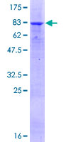ab160592 on a 12.5% SDS-PAGE stained with Coomassie Blue.