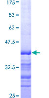 ab160673 on a 12.5% SDS-PAGE stained with Coomassie Blue.