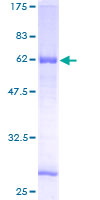 ab164686 on a 12.5% SDS-PAGE stained with Coomassie Blue.