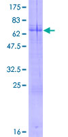ab163184 on a 12.5% SDS-PAGE stained with Coomassie Blue.