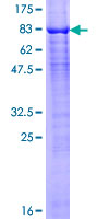 ab160984 on a 12.5% SDS-PAGE stained with Coomassie Blue.