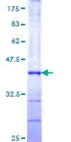 ab160985 on a 12.5% SDS-PAGE stained with Coomassie Blue.