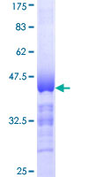 ab160701 on a 12.5% SDS-PAGE stained with Coomassie Blue.