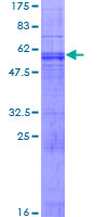 ab166208 on a 12.5% SDS-PAGE stained with Coomassie Blue.