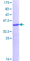 ab165871 on a 12.5% SDS-PAGE stained with Coomassie Blue.