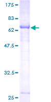 ab163808 on a 12.5% SDS-PAGE stained with Coomassie Blue.