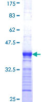 ab162512 on a 12.5% SDS-PAGE stained with Coomassie Blue.