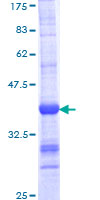 ab162971 on a 12.5% SDS-PAGE stained with Coomassie Blue.