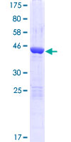 ab164057 on a 12.5% SDS-PAGE stained with Coomassie Blue.