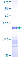 ab162504 on a 12.5% SDS-PAGE stained with Coomassie Blue.