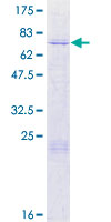 ab162593 on a 12.5% SDS-PAGE stained with Coomassie Blue.