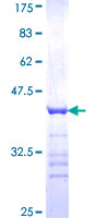 ab162594 on a 12.5% SDS-PAGE stained with Coomassie Blue.
