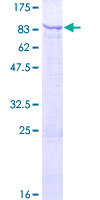 ab163898 on a 12.5% SDS-PAGE stained with Coomassie Blue.