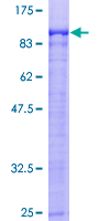 ab160710 on a 12.5% SDS-PAGE stained with Coomassie Blue.
