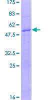 ab160711 on a 12.5% SDS-PAGE stained with Coomassie Blue.