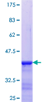 ab160712 on a 12.5% SDS-PAGE stained with Coomassie Blue.