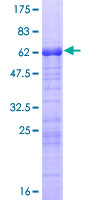 ab153046 on a 12.5% SDS-PAGE stained with Coomassie Blue.