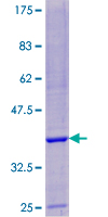 ab160808 on a 12.5% SDS-PAGE stained with Coomassie Blue.
