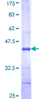 ab160809 on a 12.5% SDS-PAGE stained with Coomassie Blue.