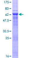 ab164605 on a 12.5% SDS-PAGE stained with Coomassie Blue.