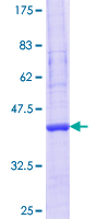 ab164606 on a 12.5% SDS-PAGE stained with Coomassie Blue.