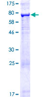 ab164913 on a 12.5% SDS-PAGE stained with Coomassie Blue.