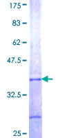 ab157909 on a 12.5% SDS-PAGE stained with Coomassie Blue.