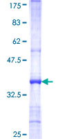 ab157912 on a 12.5% SDS-PAGE stained with Coomassie Blue.