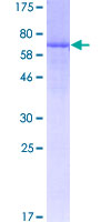 ab157913 on a 12.5% SDS-PAGE stained with Coomassie Blue.