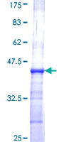 ab157914 on a 12.5% SDS-PAGE stained with Coomassie Blue.