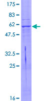 ab157915 on a 12.5% SDS-PAGE stained with Coomassie Blue.