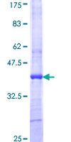 ab157916 on a 12.5% SDS-PAGE stained with Coomassie Blue.