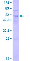 ab165117 on a 12.5% SDS-PAGE stained with Coomassie Blue.