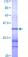 ab162657 on a 12.5% SDS-PAGE stained with Coomassie Blue.