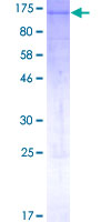 12.5% SDS-PAGE analysis of ab152176 stained with Coomassie Blue.