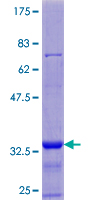 ab164059 on a 12.5% SDS-PAGE stained with Coomassie Blue.