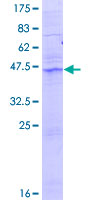 ab166280 on a 12.5% SDS-PAGE stained with Coomassie Blue.