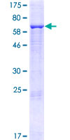 ab164126 on a 12.5% SDS-PAGE stained with Coomassie Blue.