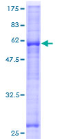 ab165271 on a 12.5% SDS-PAGE stained with Coomassie Blue.
