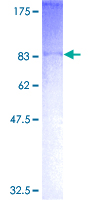 ab162633 on a 12.5% SDS-PAGE stained with Coomassie Blue.
